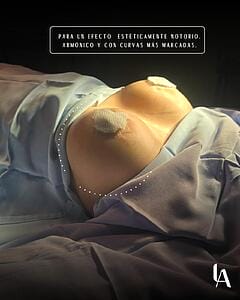 6904bc7b997ff_Dr luis aguilar cirujano plastico implantes 1